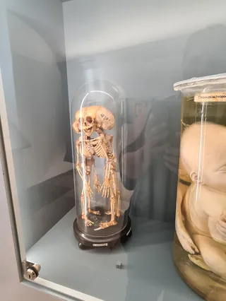 Narrenturm - Pathologisch-anatomische Sammlung