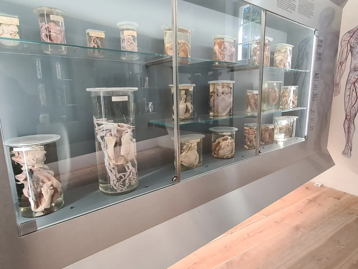 Narrenturm - Pathologisch-anatomische Sammlung