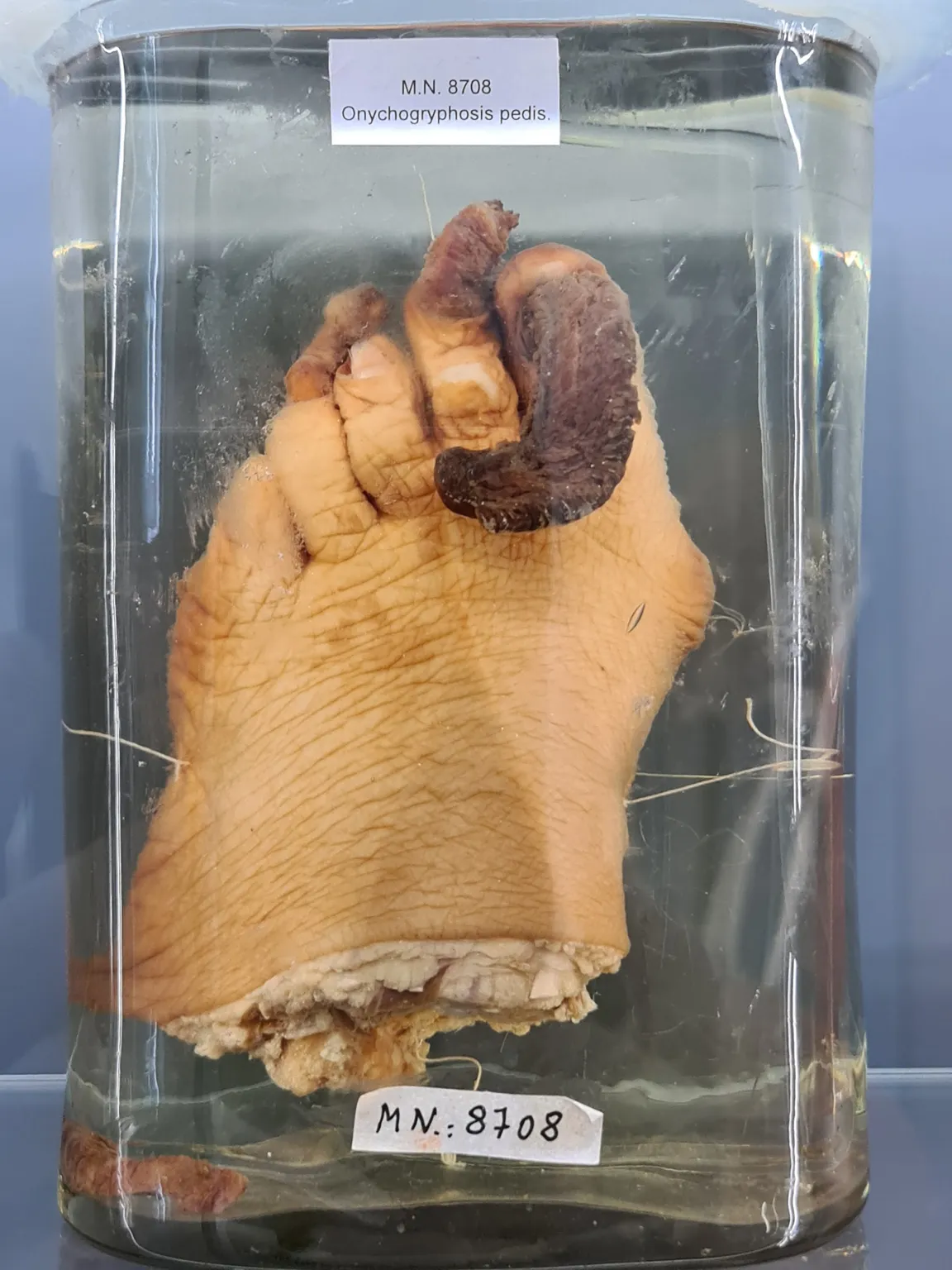 Narrenturm - Pathologisch-anatomische Sammlung