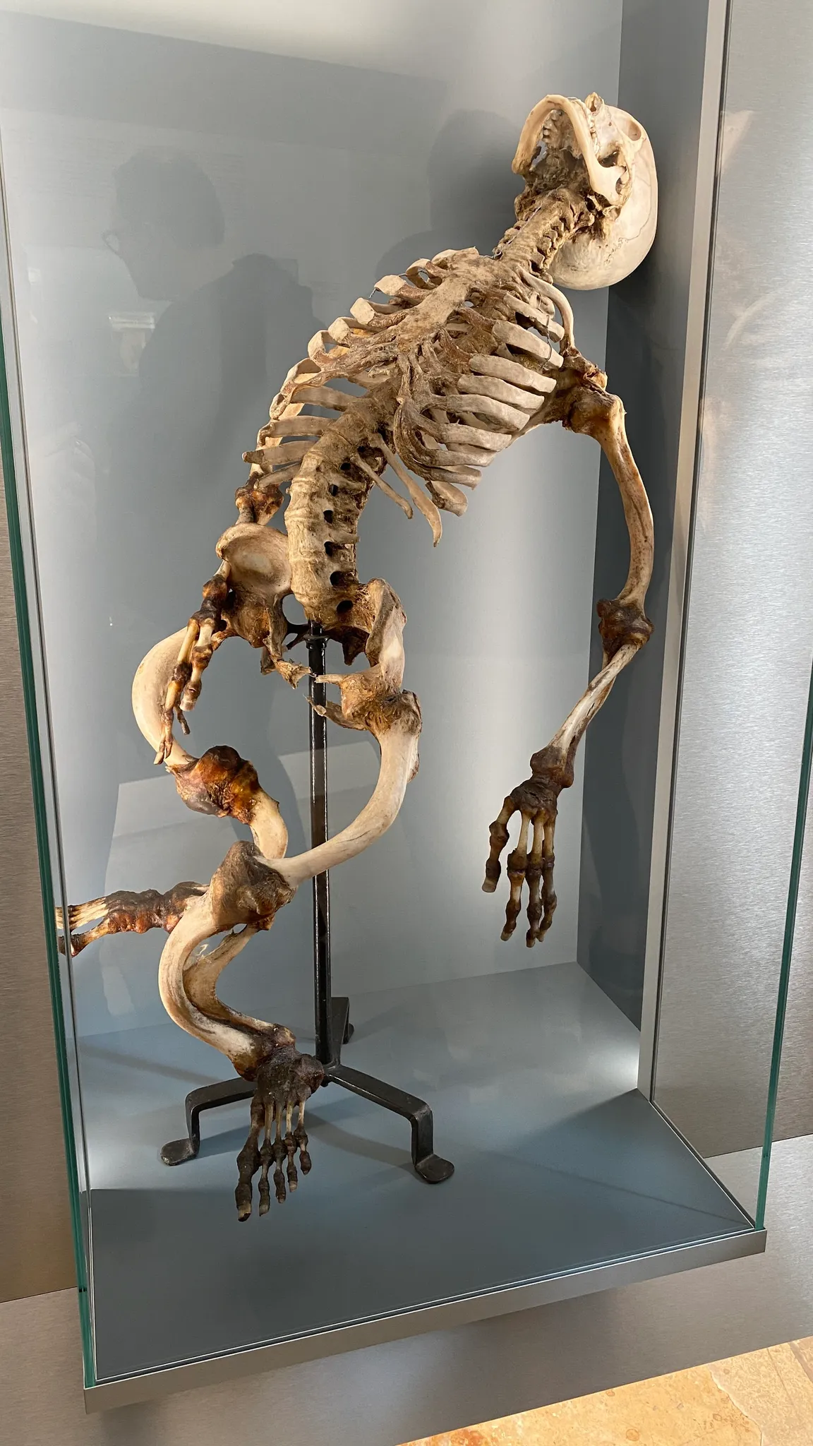 Narrenturm - Pathologisch-anatomische Sammlung